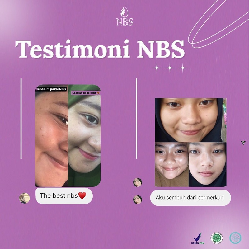 N B S EXTRA GLOW N B S ULTIMATE PEMUTIH WAJAH PENGHILANG FLEK JERAWAT ORIGINAL NONI BEAUTY SKINCARE