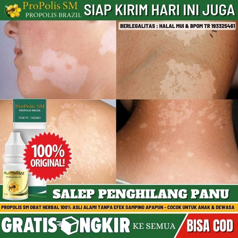 Obat Panu Salep, Obat Panu di Wajah,  Obat Panu di Tangan / Leher / Punggung / Kaki, Obat Oles Mengh
