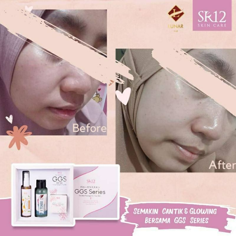 GGS SR12 / GLOW GLASS SKIN GEL / MENCERAHKAN KULIT WAJAH / RED GEL