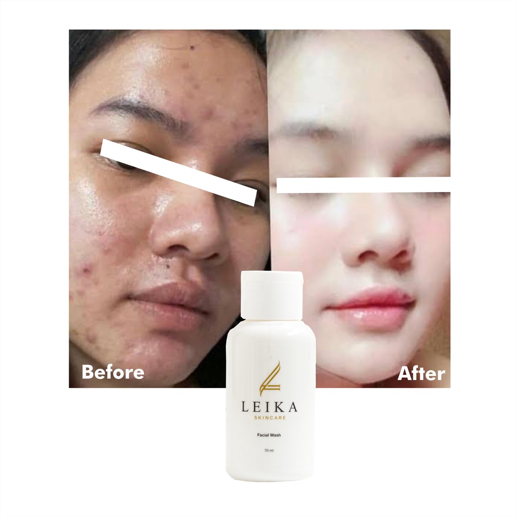 Mantap! Sabun Wajah Penyegar Pelembab Kulit Wajah Anti Aging Penyembuhan Luka Jerawat Pengangkat Sel sel Kulit Mati Penghalus Kulit Wajah Pembersih Pori-pori Wajah Pereda Peradangan Akibat Jerawat Facial Wash Skincare Resmi BPOM