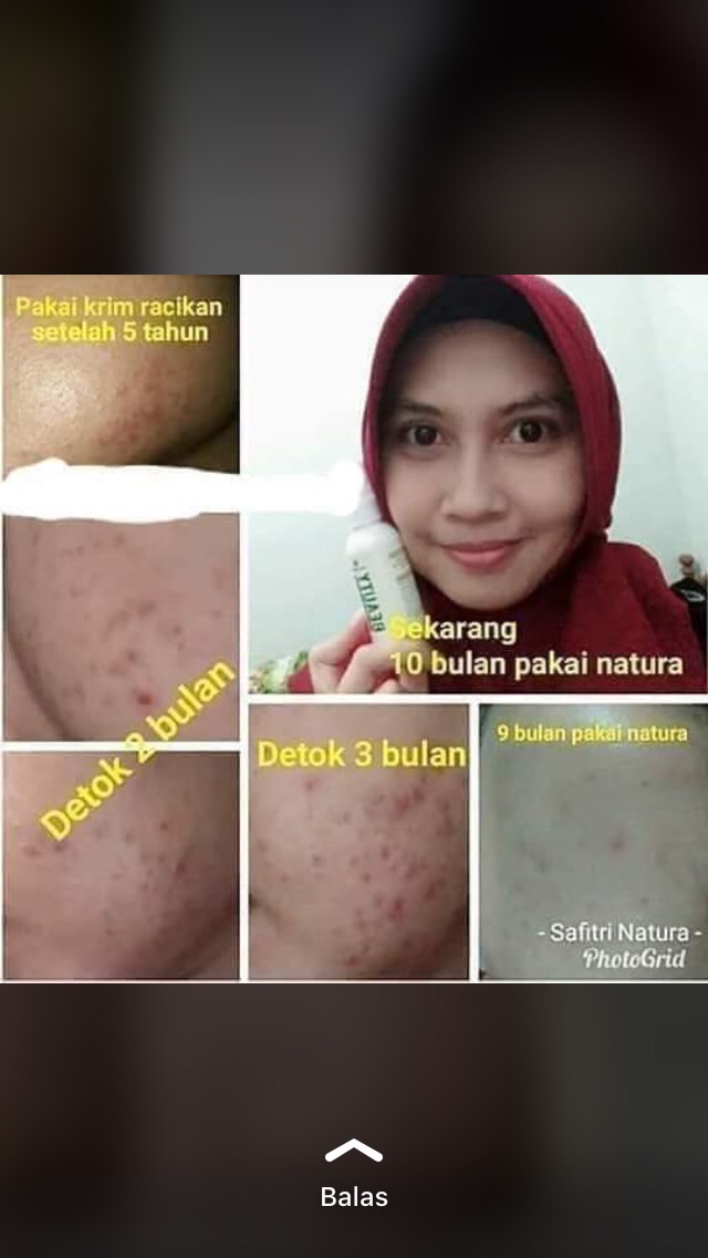 Natura Beauty Spray Original Asli(free Masker Kain 3lapis)