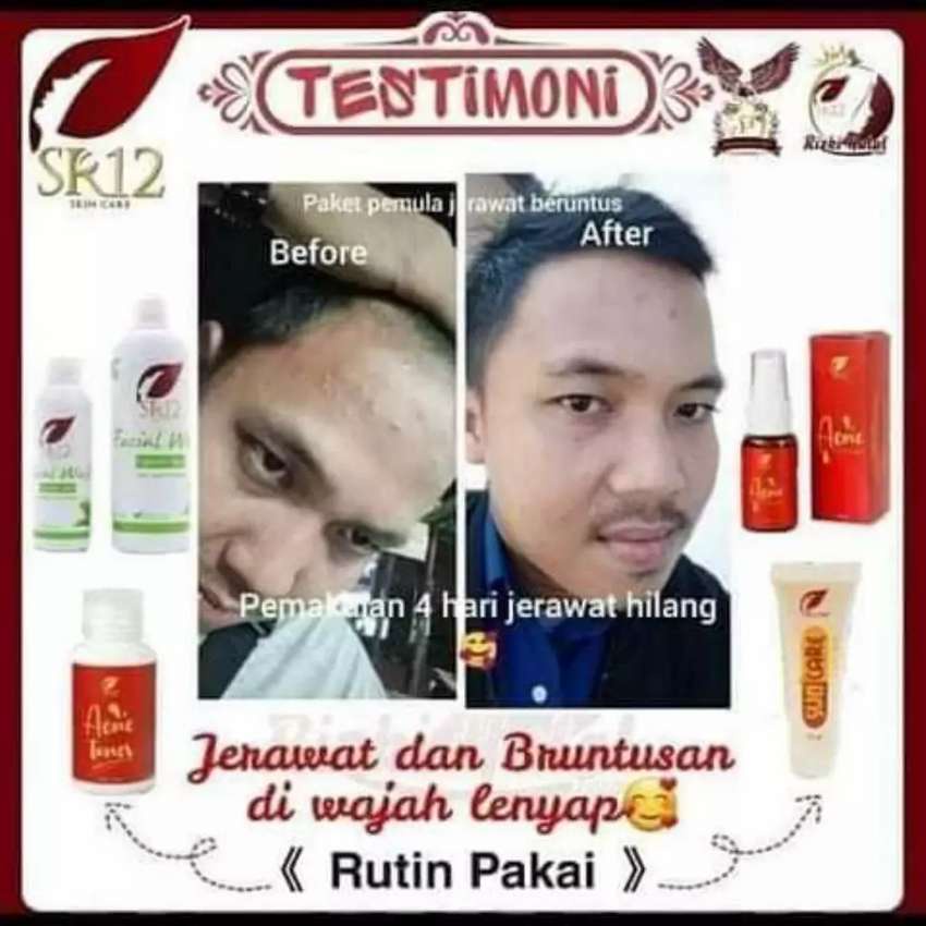 Serum SR12 | Acne Serum SR12 &amp; Revitalizing Serum SR12 | Serum Wajah SR12 Skincare | Pembersih Wajah