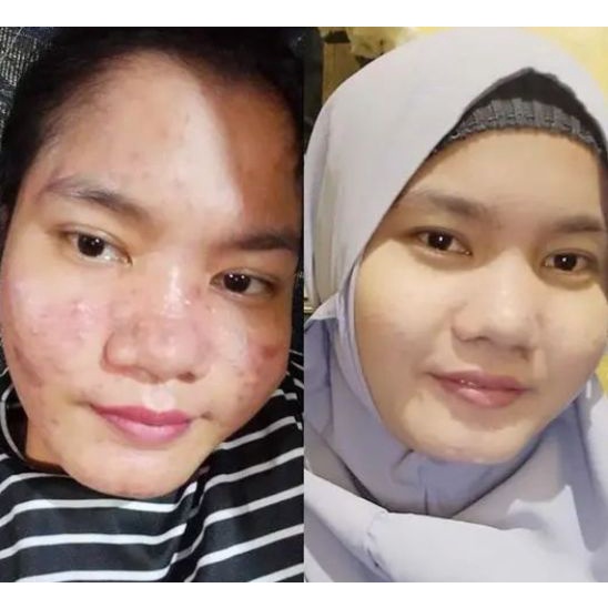 CREAM WAJAH GLOWING BPOM KUNTZE BB GLOW SPIRULINA KRIM WAJAH GLOWING KECANTIKAN PERAWATAN WAJAH