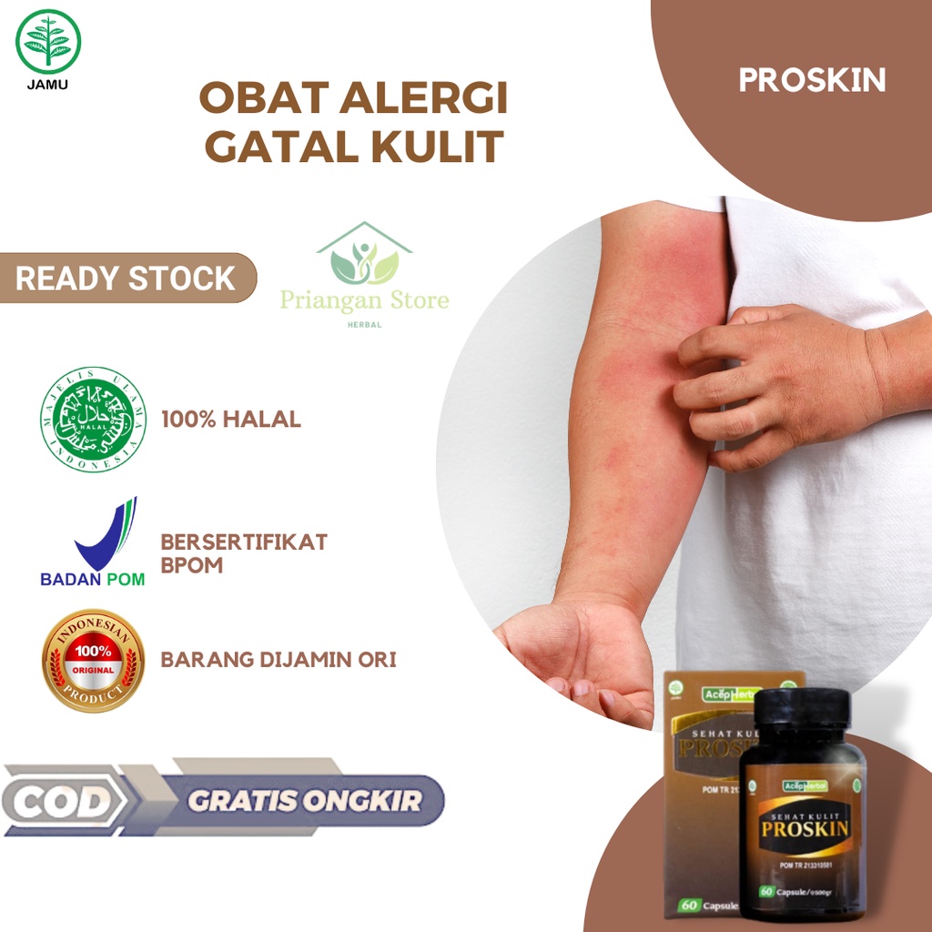 Obat Alergi Gatal Kulit, Biduran, Gatel Alergi, Alergi Dingin, Alergi Makanan, Gatel Bentol, Alergi 