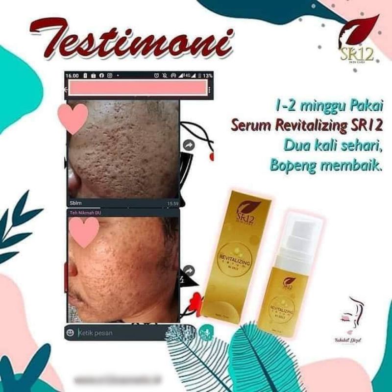 SR12 Revitalizing Serum Colagen Atas Bopeng Bekas Jerawat Lingkar Hitam Mata Panda Melembabkan dan Mencerahkan Kulit Wajah