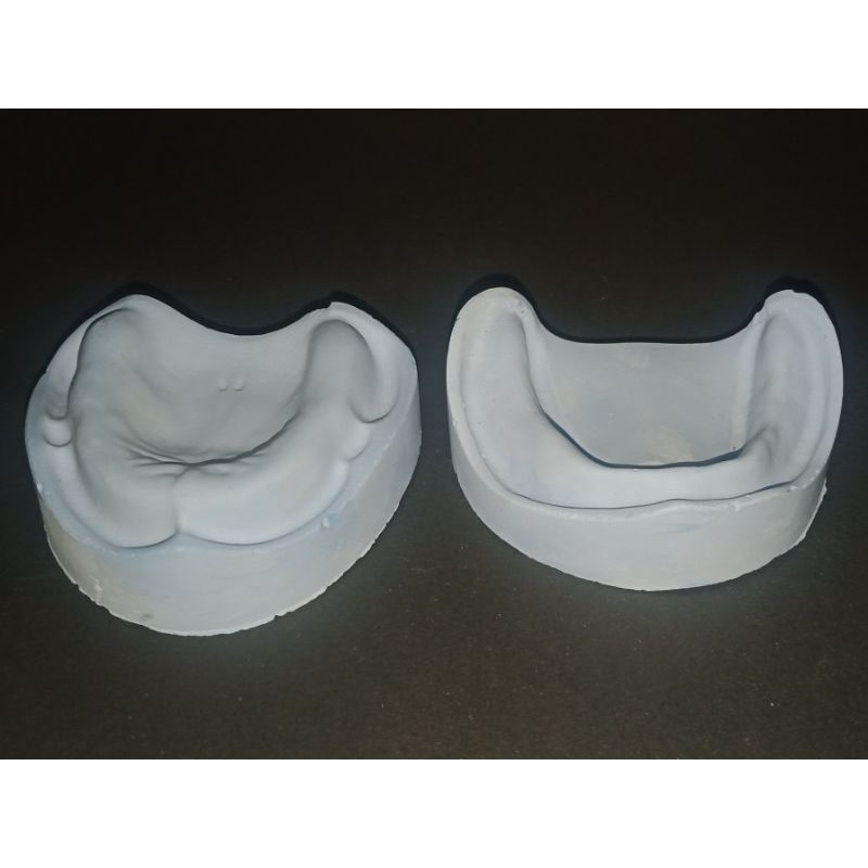 Model gigi ompong/ model gips edentulous