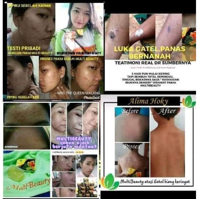 Multi Beauty Soap (MBS)