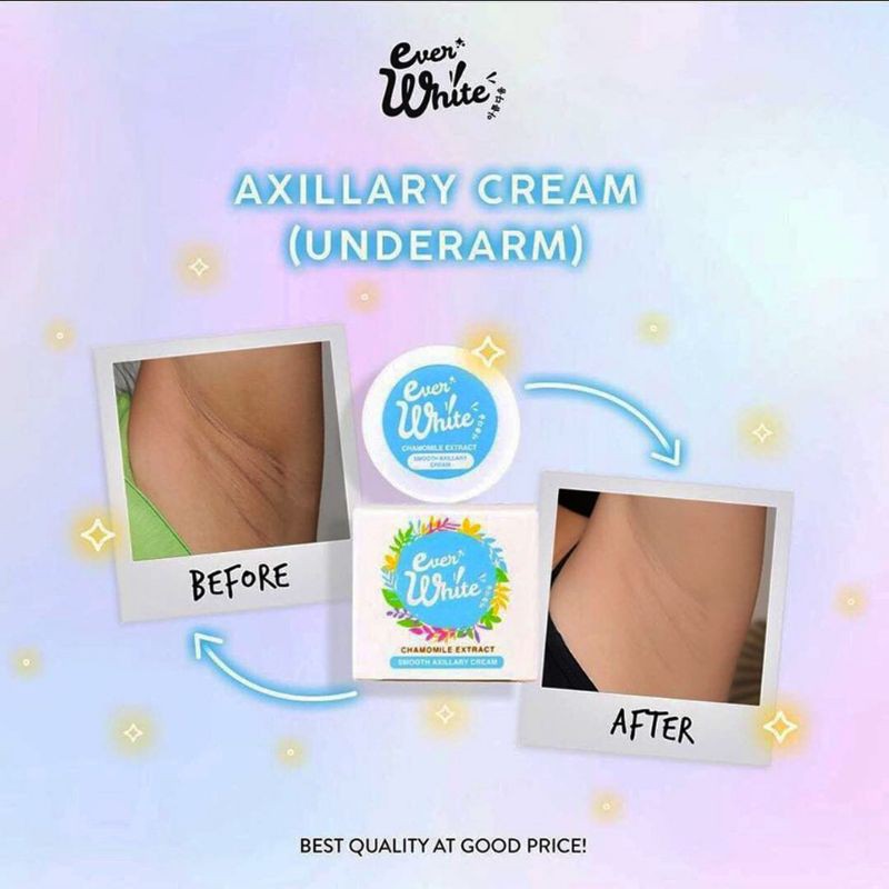 Everwhite Auxiliary Cream (Underarm) Blue