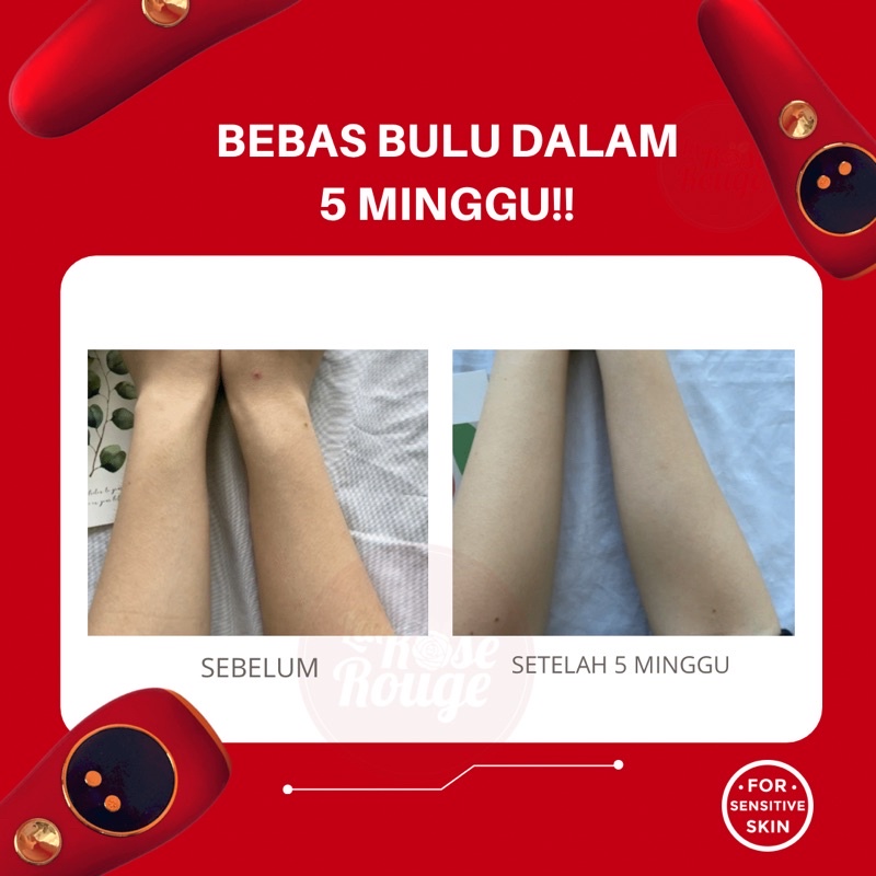 IPL LASER HAIR REMOVAL PERONTOK BULU PERMANENT ALAT PENGHILANG BULU TANPA SAKiT