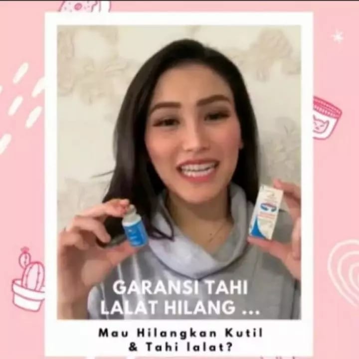 SwissParis Lotion - Lotion Penghilang Kutil - Obat Penghilang Kutil - Obat Perontok Kutil Paling Ampuh Original - Obat Lotion Penghilang Perontok Kutil Kelamin dan Mata Ikan - Obat Penghilang Mata Ikan - Swiss Paris Original Lotion Penghilang Kutil