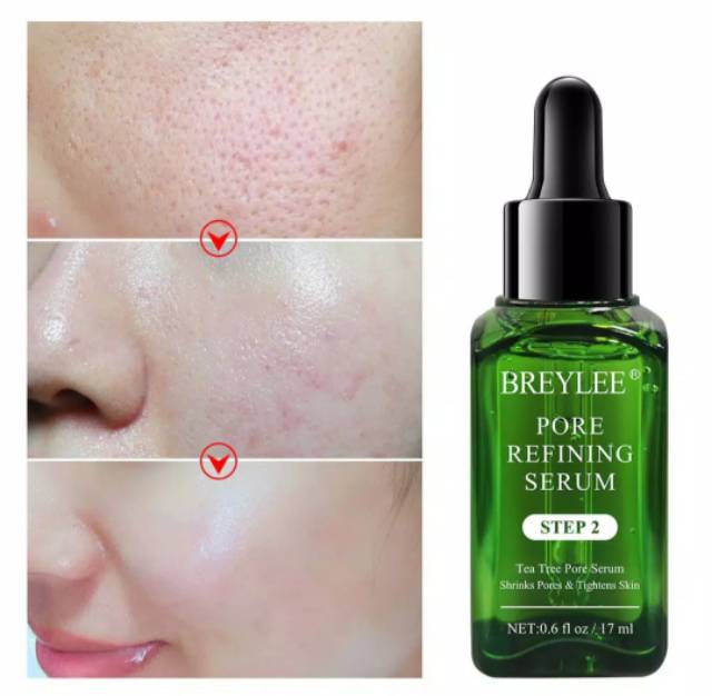 Breylee Step 2 Serum Wajah Pengecil Pori-pori skincare Pemurnian Pori