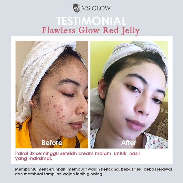 Ms Glow Red Jelly Extra Glowing / Flawless Glow Red Jelly Ms Glow / Sleeping Mask Ms Glow Original