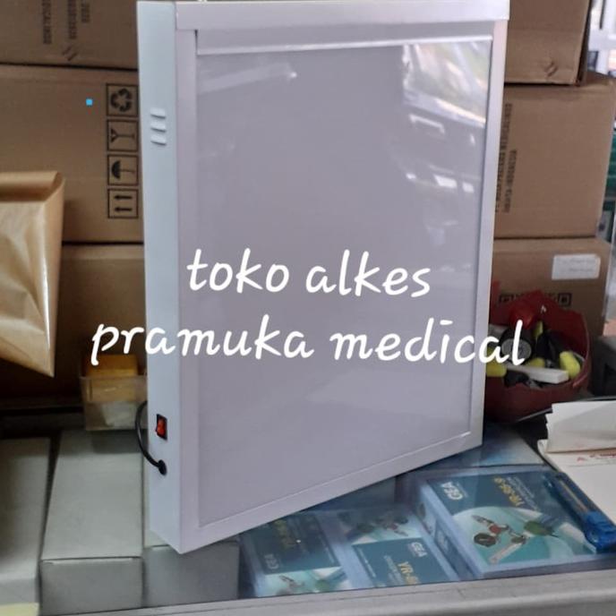 x ray viewer singgle lampu baca rontgen singgle LED