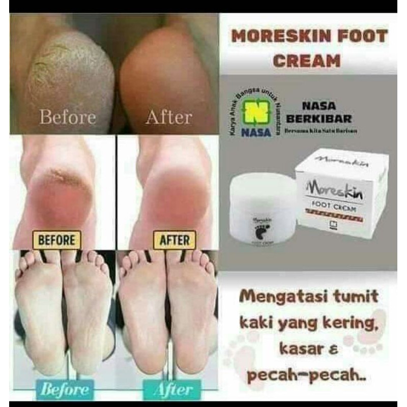 

Moreskinfootcream