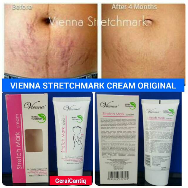 VIENNA STRETCHMARK CREAM - CREAM PENGHILANG STRETCHMARK PALING AMPUH