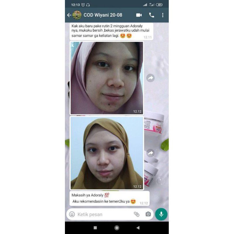 Adoraly Skincare BPOM ORI Aman Busui (1 Paket)[Bonus POUCH+TUMBLER+Masker]-7