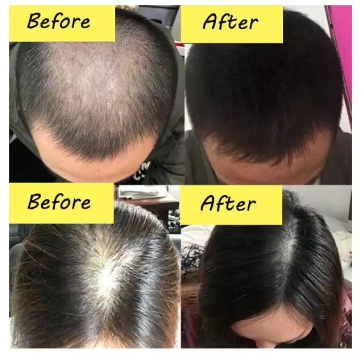 Shampo herbal jahe profesional anti-rambut rontok/gatal/ketombe minyak kontrol menyegarkan 400ml