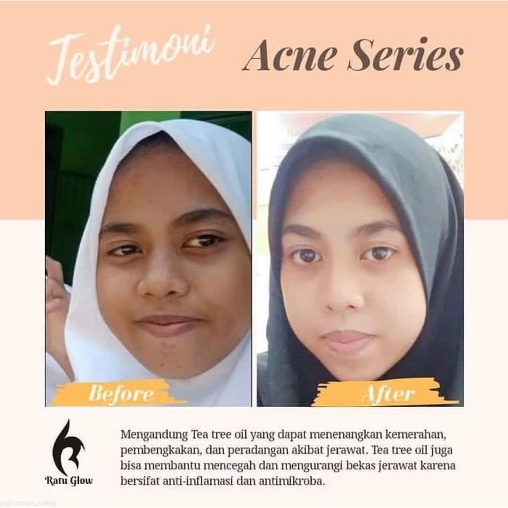 Ratu Glow Skincare Toner Brightening Lightening Pembersih Wajah Penghilang Noda Dan Kotoran Bekas Make Up Pembersih Kulit Wajah Penutrisi Kulit Atasi Sisa Make Up Kulit Berminyak