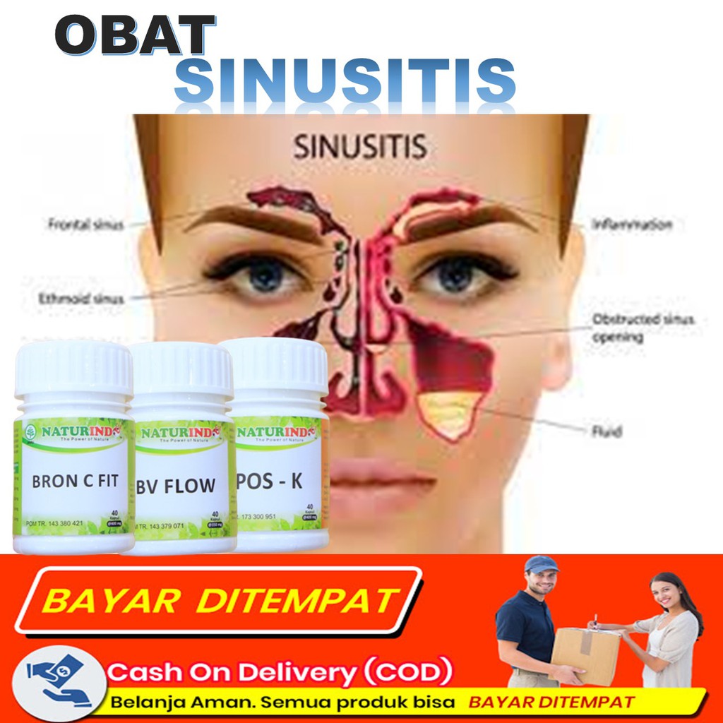 Jual Obat Sinusitis Dan Polip Hidung Menahun Paling Ampuh Herbal Sinus