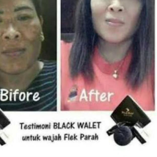 ⅍ SABUN Wajah Muka WALET HITAM ORIGINAL ASLI BLACK WALET FACIAL SOAP Menghilangkan Jerawat & Flek BP