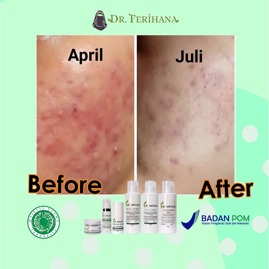 Galactomyces Night Cream For Oily &amp; Acne DR. FERIHANA COSMETICS &amp; SKINCARE Merupakan Krim Malam untuk Kulit Berminyak Berjerawat Flek Hitam Mencerahkan Sekaligus Anti Aging BPOM LPPOM HALAL MUI