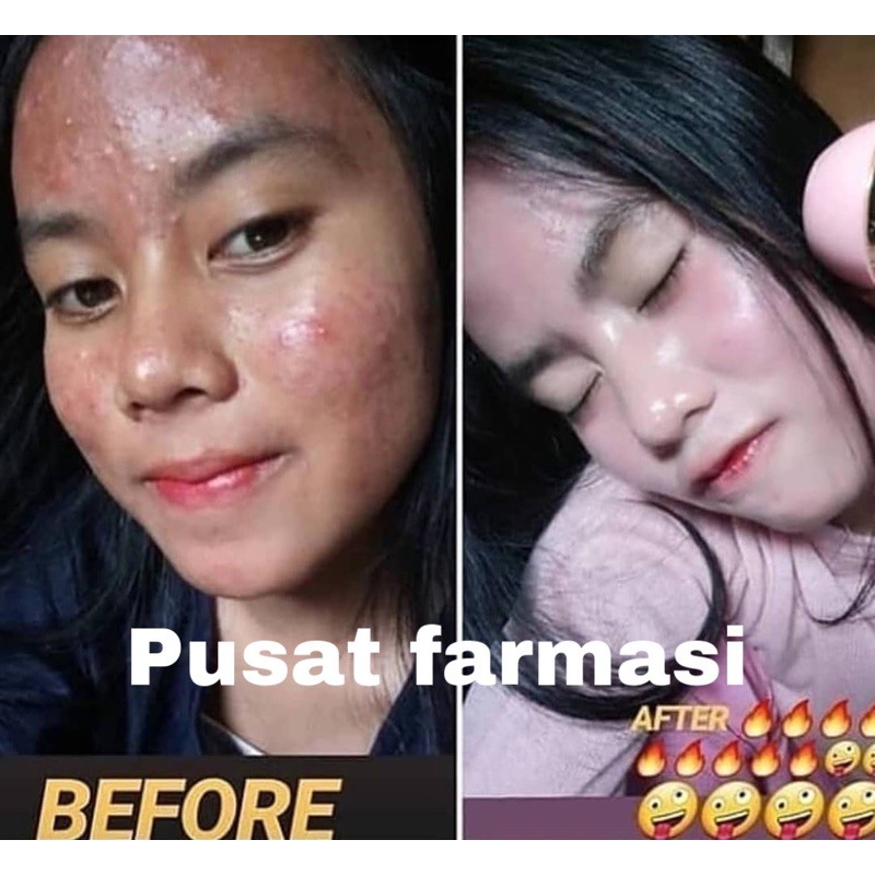 PAKET WHITENING WAJAH | PAKET USAHA