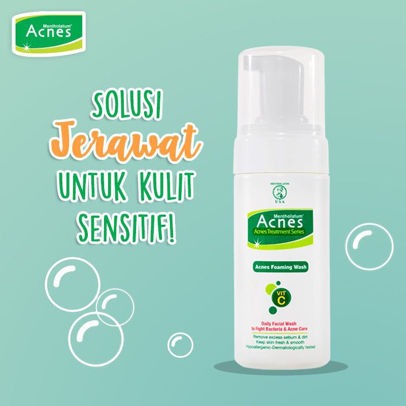 Acnes Treatment Series | Washing Bar 80gr | Foaming Wash 100ml | Powder Skincare Acnes By AILIN