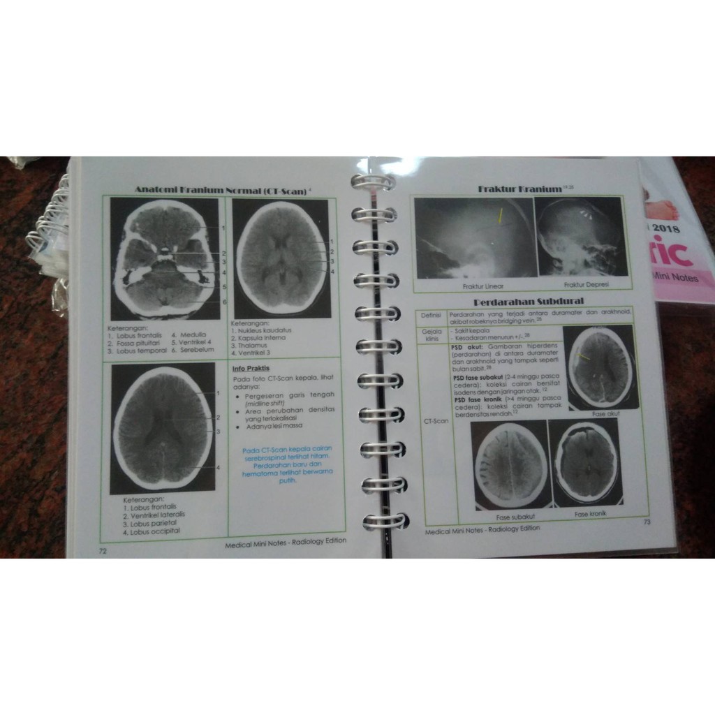 Medical Mini Notes Radiology Mmn Radiology Mmn Radiologi Edisi 2020 Buku Saku Kedokteran Shopee Indonesia