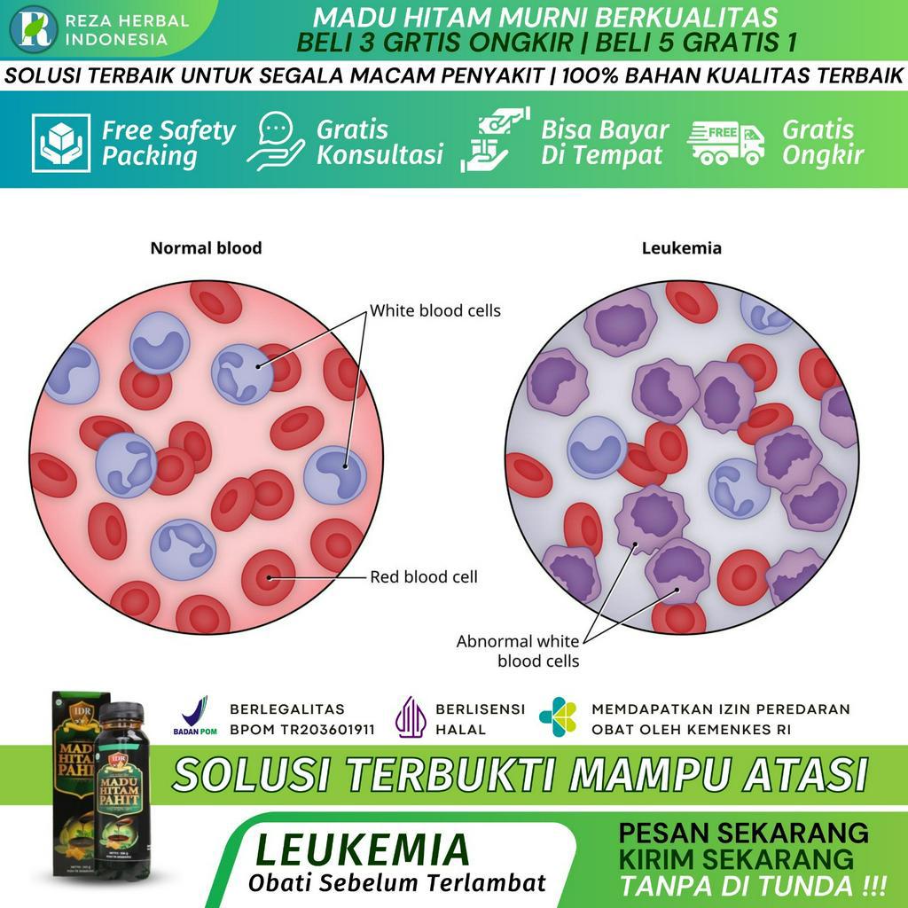Obat Leukemia - IDR MADU HITAM
