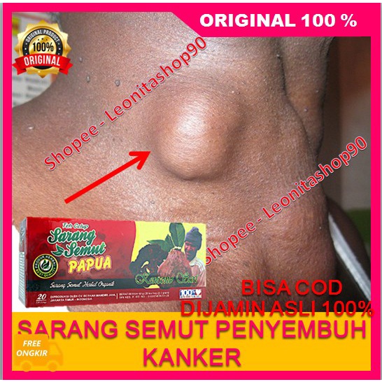 

BELI 1 GRATIS 1 Teh Sarmut Papua Menghempaskan Benjolan 100% ORIGINAL