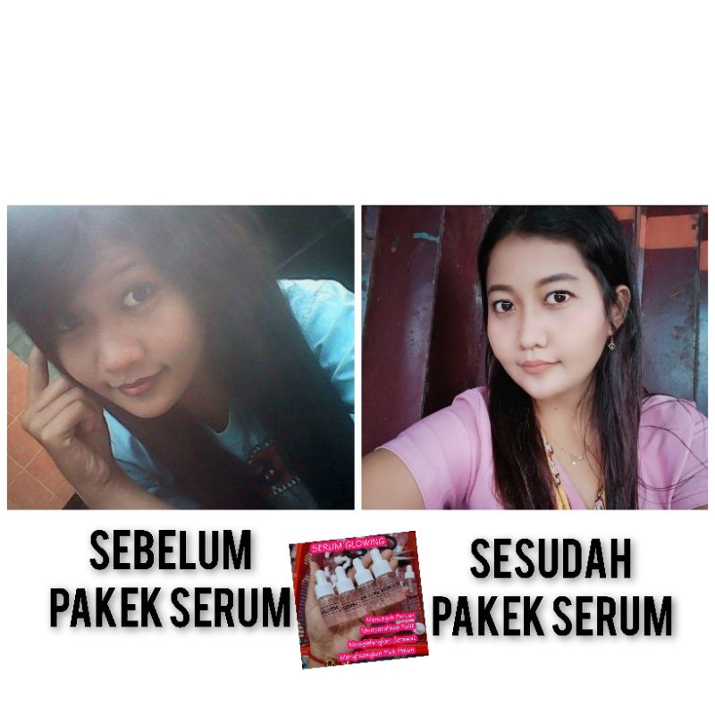 PAKET USAHA SERUM GLOWING VIRAL  10-100BOTOL/PAKET MURAH