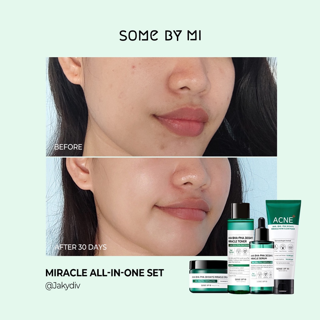 SOME BY MI Aha Bha Pha 30 Days Miracle AC SOS Kit Menenangkan Kulit Wajah