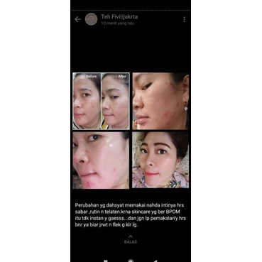 BAYAR DITEMPAT || NAHDA SKINCARE ORIGINAL 100% ORIGINAL || FREE BONUS MENARIK !!-2