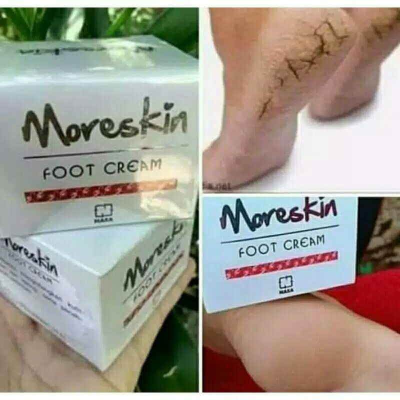 Obat kaki pecah2 - Obat kaki pecah dan kering  - Food Cream Nasa - Cream kaki pecah2 - Cream kaki