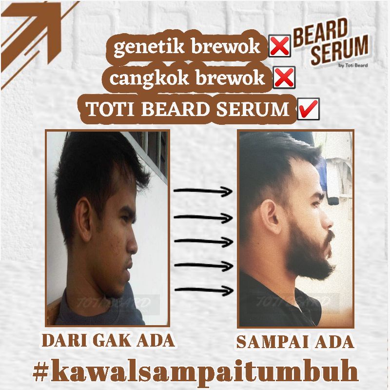 SERUM KHUSUS PENUMBUH BULU BREWOK TANPA GEN #TOTIBEARDSERUM