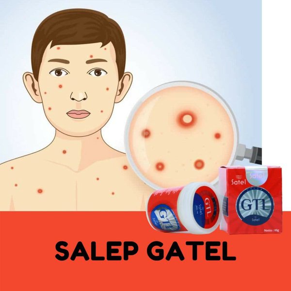 Salep GTL Original 100% Asli Gatel Usir Kudis Kurap Panu Korengan-3