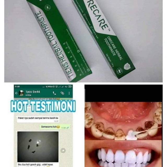 Jual whitening toothpaste ORECARE TIENS ASLI ORI SEGEL Shopee