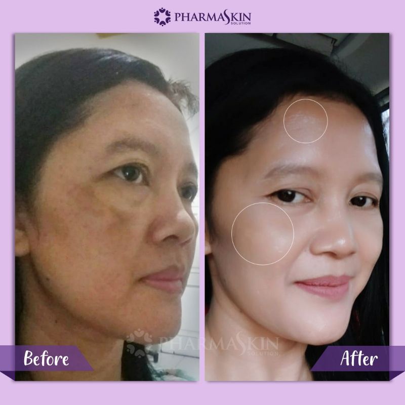 Pharmaskin Paket Skincare Intensive Night Cream Flek Hitam Menahun Perawatan Wajah Menghilangkan Noda Hitam Resmi Halal BPOM Ampuh Original-4