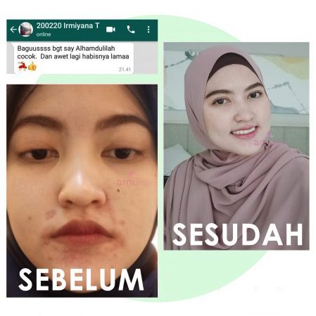 REGLOW CREAM KRIM CREM REJUVENATING INTENSIVE CREAM WAJAH KRIM PENGHILANG JERAWAT ORIGINAL 100% BPOM PENGHILANG BEKAS JERAWAT PENGHILANG FLEK HITAM