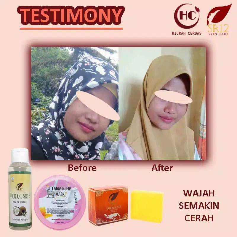 ETAWA KEFIR MASK SR12 BPOM/KEFIR ETAWA MASK SR12/KULIT BERMINYAK&amp;BERJERAWAT/KEFIR MASK SUSU KAMBING