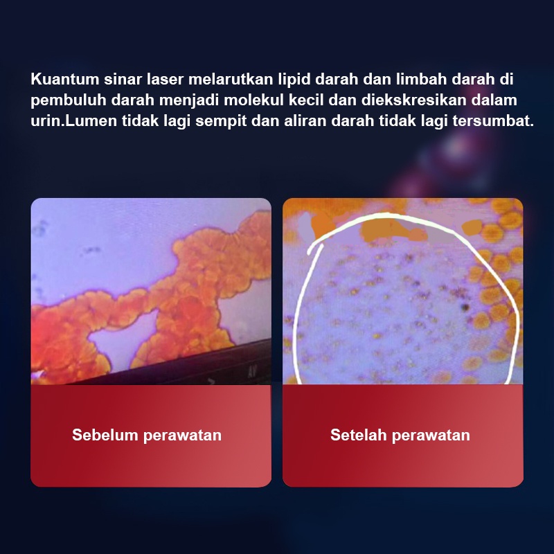 Jam tangan Terapi laser 7/12/15 titik dr laser fisioterapi untuk jantung mempercepat pemulihan stroke[100%ORI]