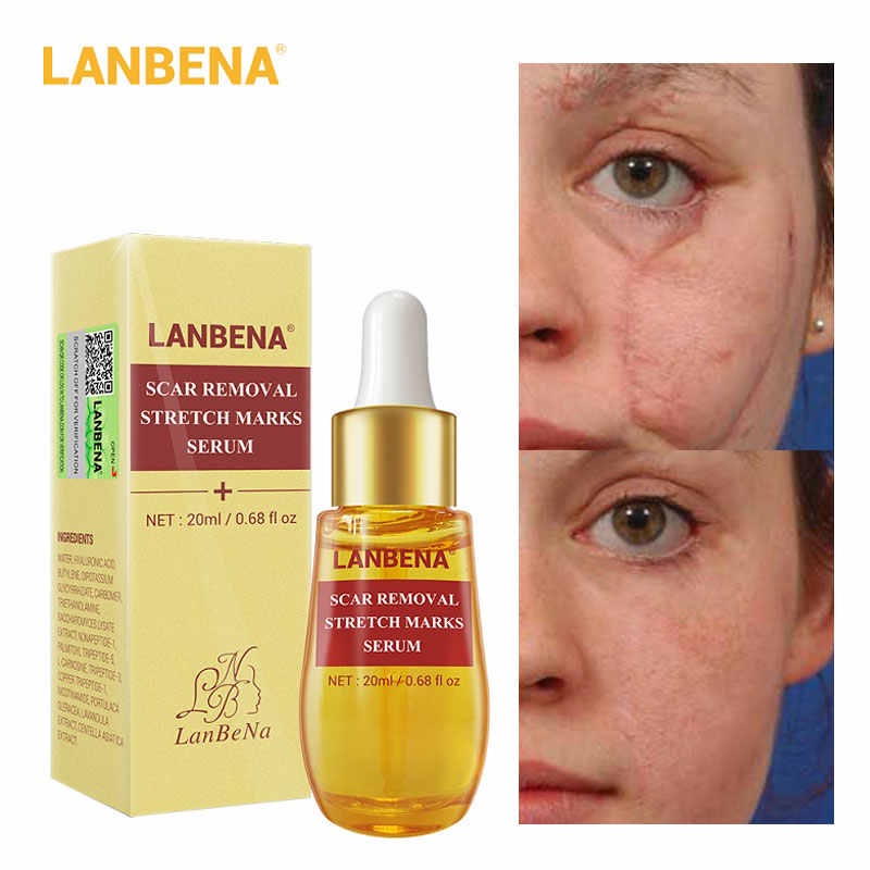 LANBENA SCAR REMOVAL STRETCH MARKS SERUM Penghilang Bekas Luka Stretch Mark