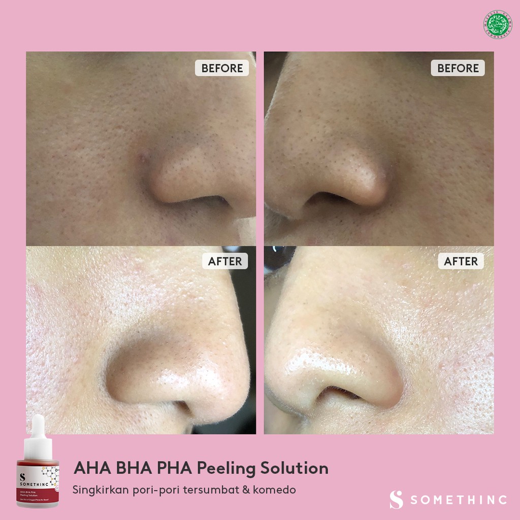 SOMETHINC AHA BHA PHA / AHA 7%, BHA 1%, PHA 3% Weekly Peeling Solution