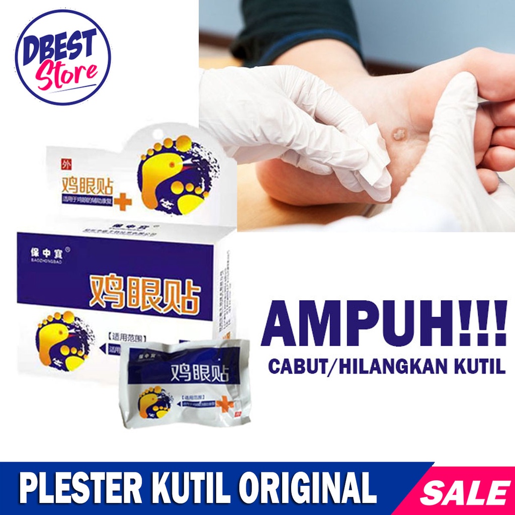 (1Box isi 6 Pcs) Plester Obat Kutil &amp; Mata Ikan / Kapalan Koyo Kutil / Plester Obat Penghilang Kutil