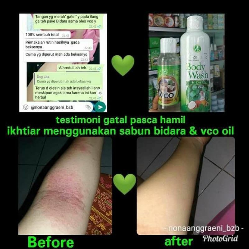 SABUN BIDARA REFIL BATRISYIA 1000 ML SABUN/ OBAT UNTUK PANU KUDAP URAP JERAWAT PUNGGUNG GATAL GATAL