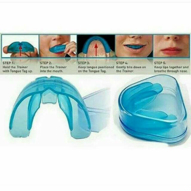 Pengganti kawat gigi #untuk gigi lebih rapi