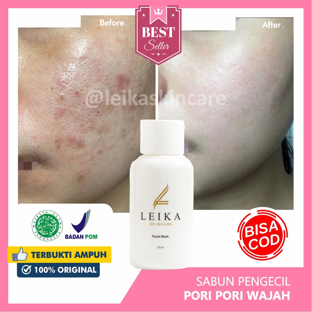 Facial Wash / Sabun Pembersih Pori pori untuk Kulit Wajah Asli 100% Halal Pembersih Wajah Mengecilkan Pori pori Ampuh BPOM Sabun Pengecil Pori pori Facial Wash Leika Skincare - 70ml Resmi BPOM Halal