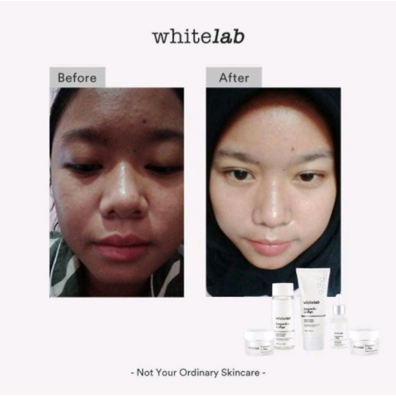 Whitelab Brightening Paket Wajah & Serum 100% ORI dan TERLARIS !!!-5