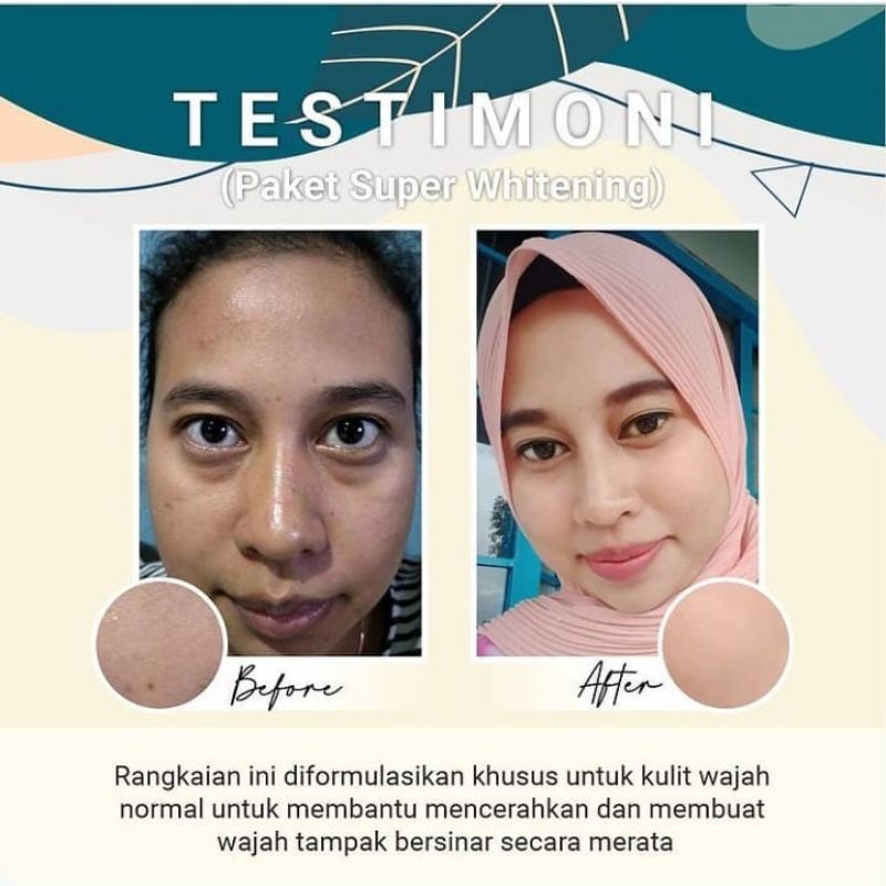 Jglow Skincare J glow Paket Super Whitening Cream klinik JNC 1 Farmasi Dokter JNC 9 Skin glowing Per