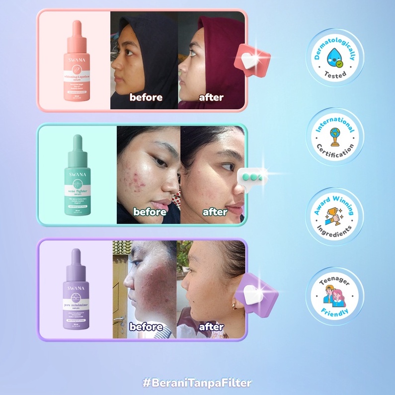 ✨ AKU MURAH ✨ SWANA Face Serum Series / Whitening Brightening Spotless / Acne Fighter / Pore Minimizer Peeling Beauty BPOM